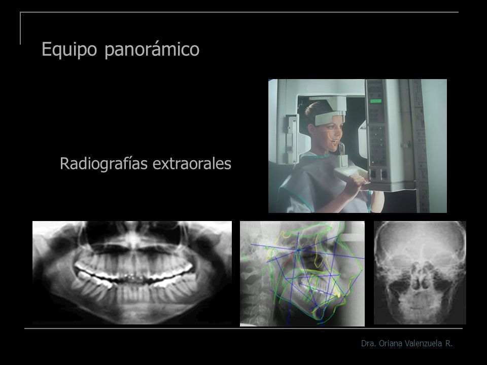 Equipo panorámico Radiografías extraorales Dra. Oriana Valenzuela R.