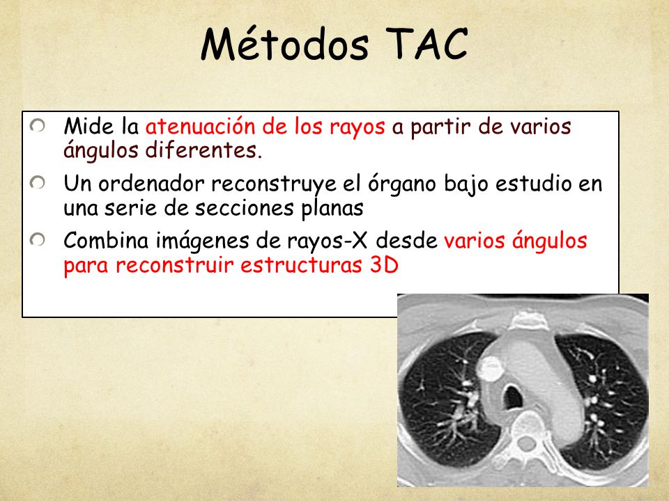 Métodos TAC Mide la atenuación de los rayos a partir de varios ángulos diferentes.