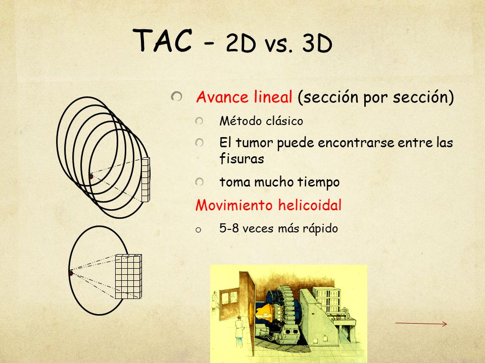 TAC - 2D vs. 3D Avance lineal (sección por sección)