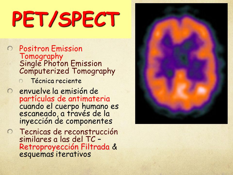 PET/SPECT Positron Emission Tomography Single Photon Emission Computerized Tomography. Técnica reciente.