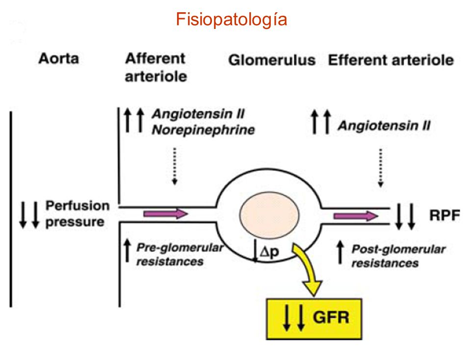 Fisiopatología Entonces utilizamos diuréticos que llevan a un empeoramiento del volumen efectivo y empeoran la función renal.