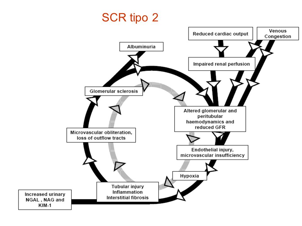 SCR tipo 2 Circulo vicioso de la relación corazón riñón