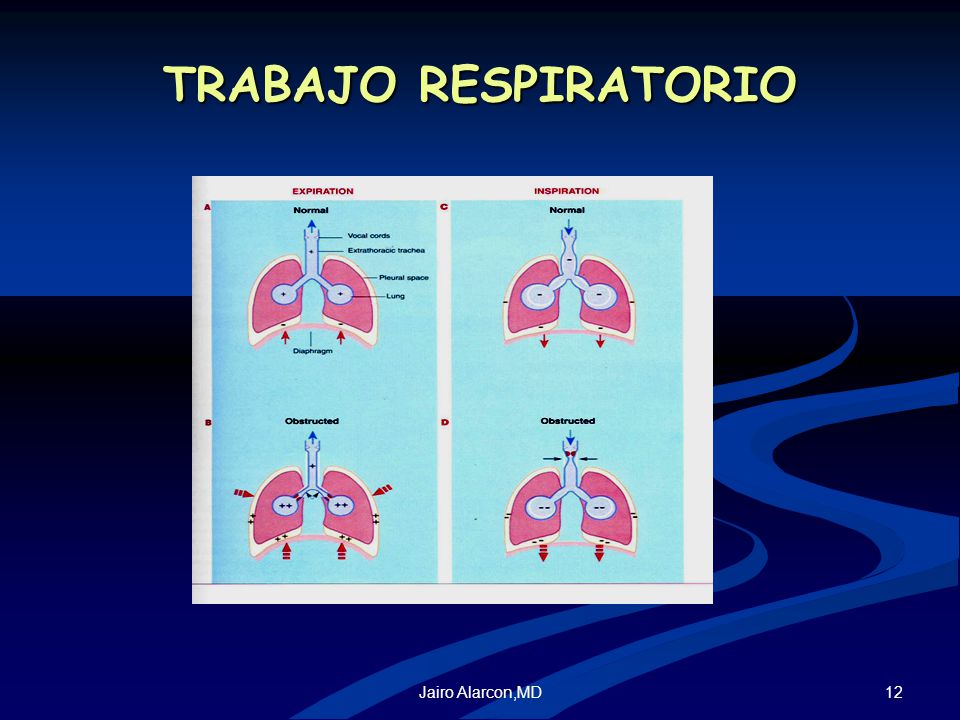 TRABAJO RESPIRATORIO Jairo Alarcon,MD