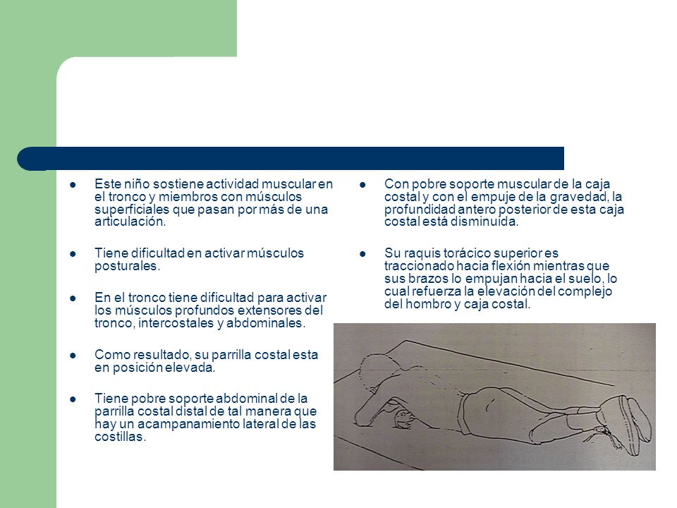 Este niño sostiene actividad muscular en el tronco y miembros con músculos superficiales que pasan por más de una articulación.