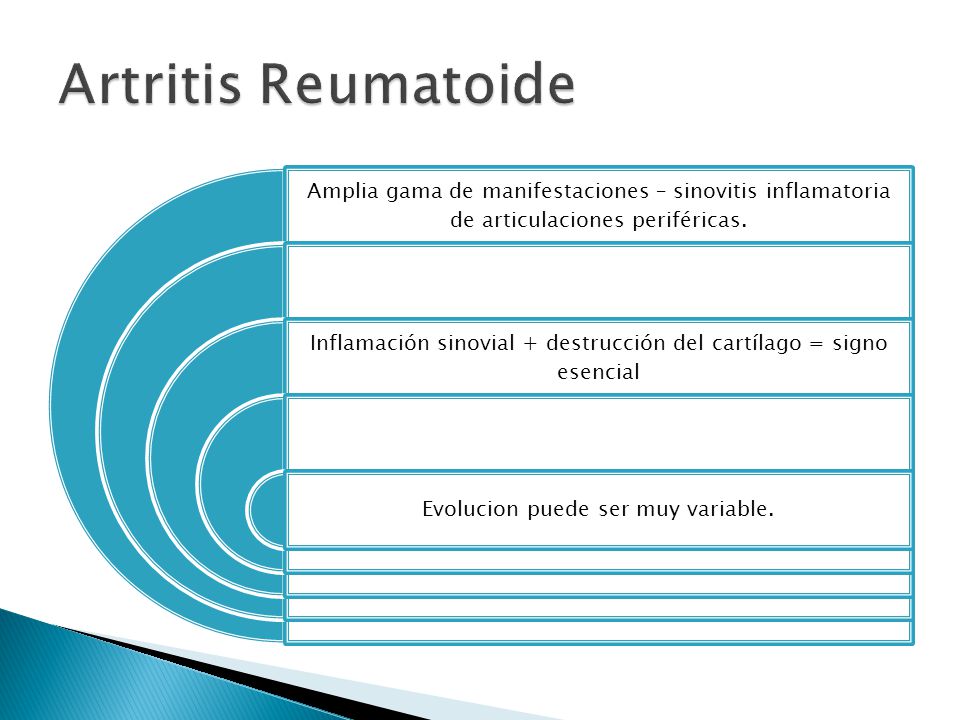 Artritis Reumatoide Amplia gama de manifestaciones – sinovitis inflamatoria de articulaciones periféricas.