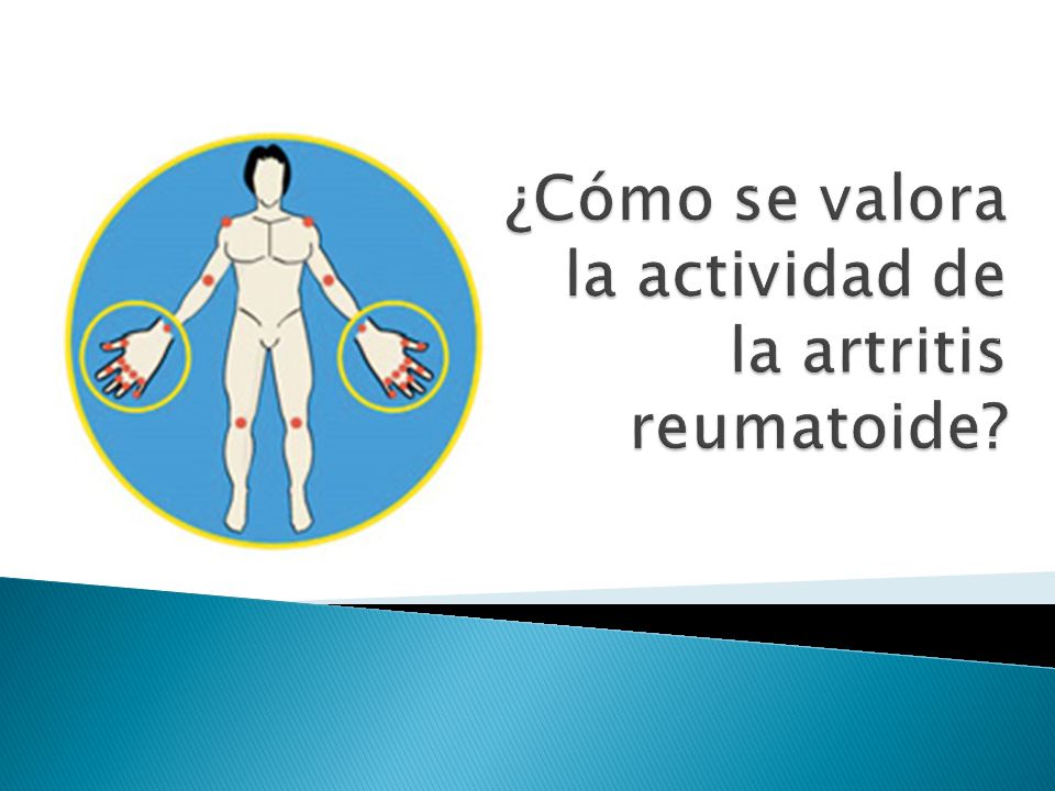 ¿Cómo se valora la actividad de la artritis reumatoide