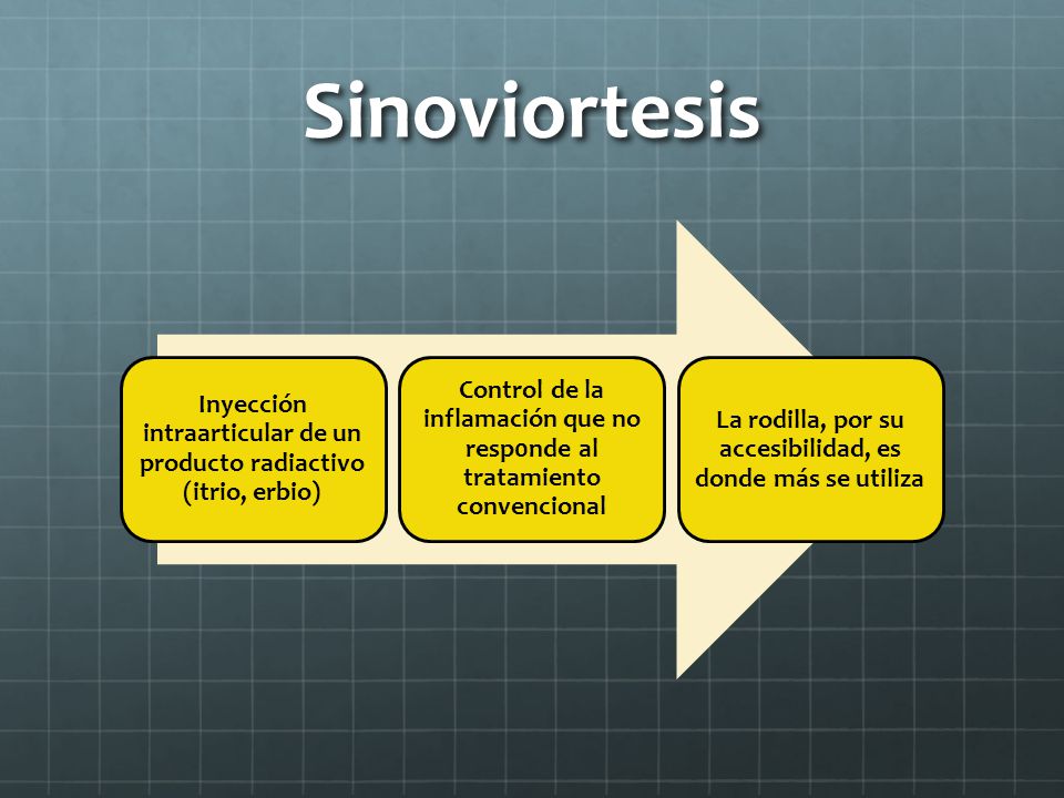 Sinoviortesis Inyección intraarticular de un producto radiactivo (itrio, erbio)