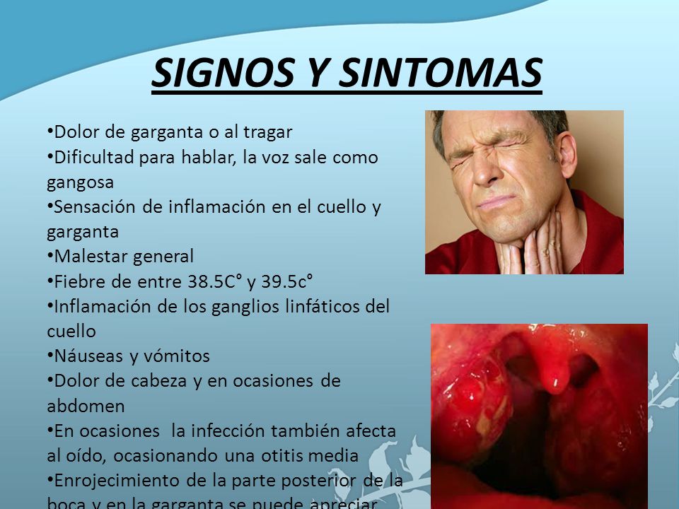 SIGNOS Y SINTOMAS Dolor de garganta o al tragar