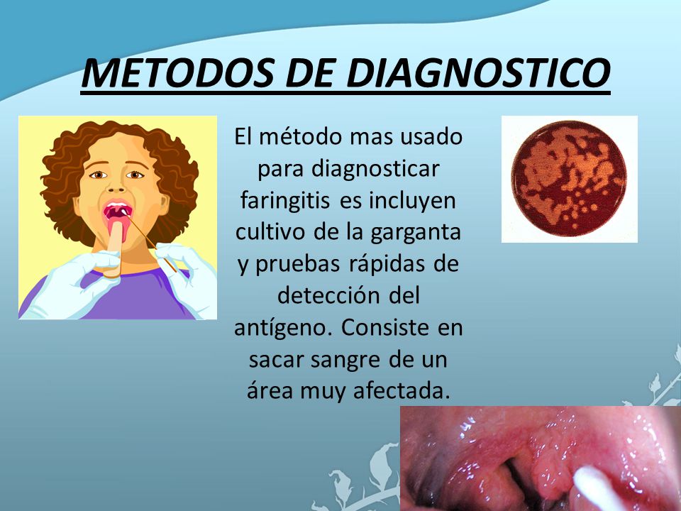 METODOS DE DIAGNOSTICO