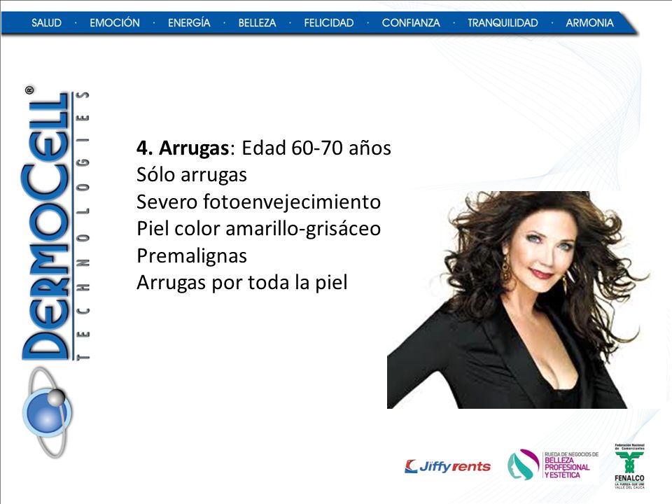 4. Arrugas: Edad años Sólo arrugas. Severo fotoenvejecimiento. Piel color amarillo-grisáceo.