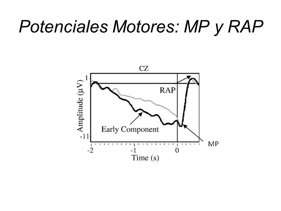 Potenciales Motores: MP y RAP