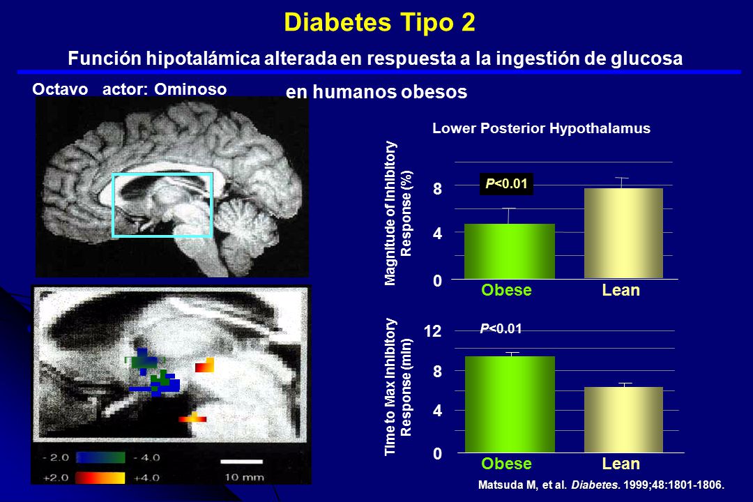 Diabetes Tipo 2 Función hipotalámica alterada en respuesta a la ingestión de glucosa. en humanos obesos.
