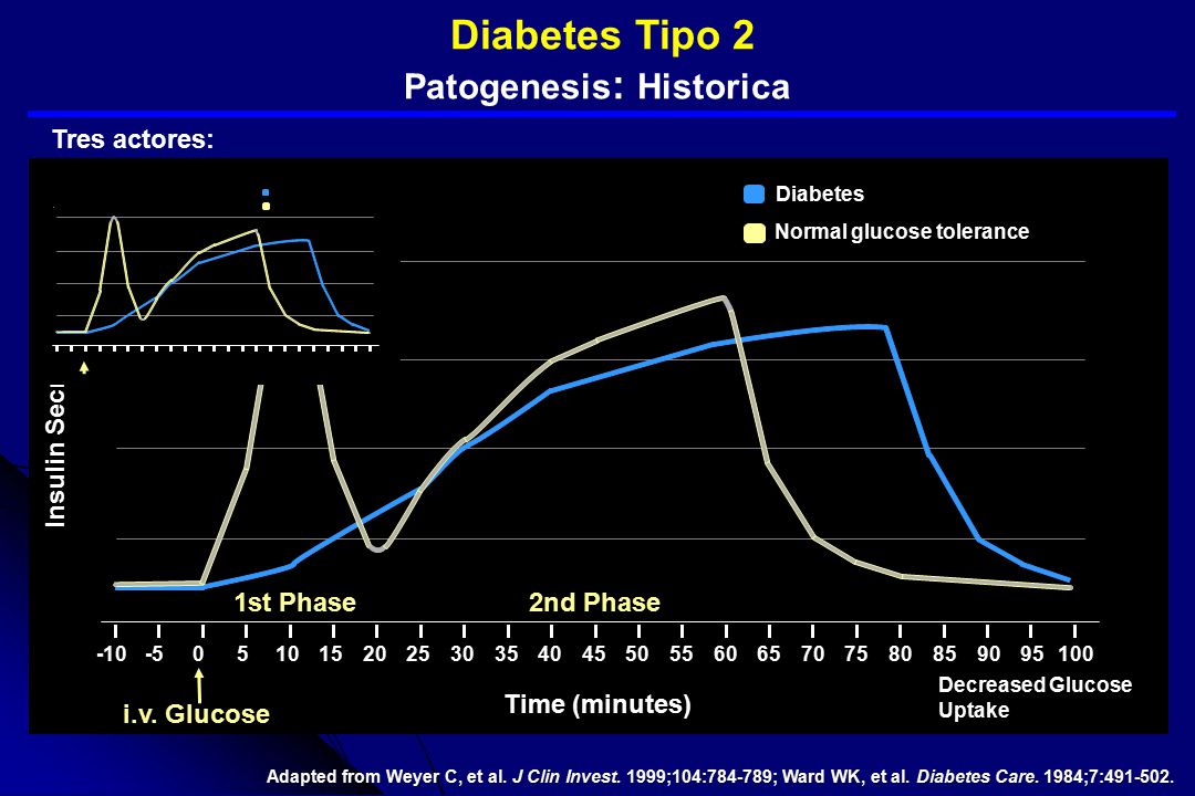 Hiperglucemia Diabetes Tipo 2 Patogenesis: Historica