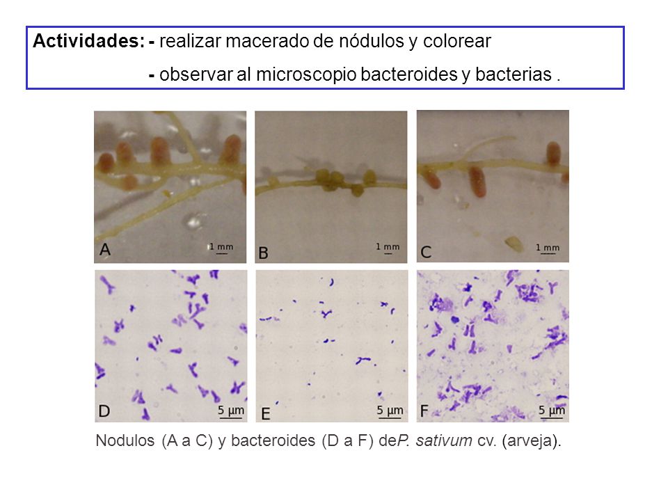 Actividades: - realizar macerado de nódulos y colorear