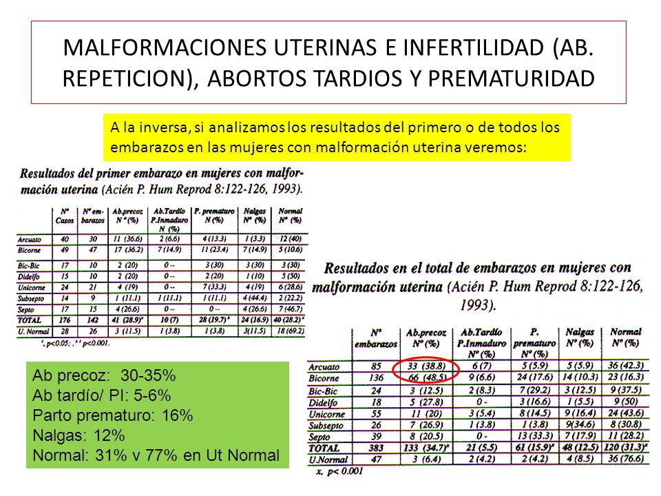 MALFORMACIONES UTERINAS E INFERTILIDAD (AB