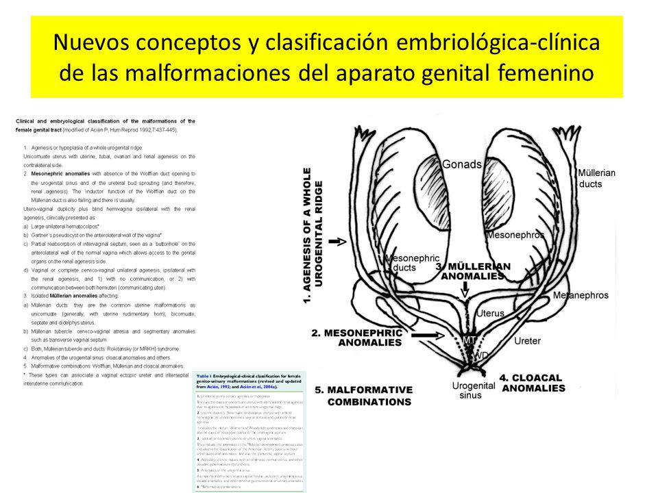 Nuevos conceptos y clasificación embriológica-clínica de las malformaciones del aparato genital femenino