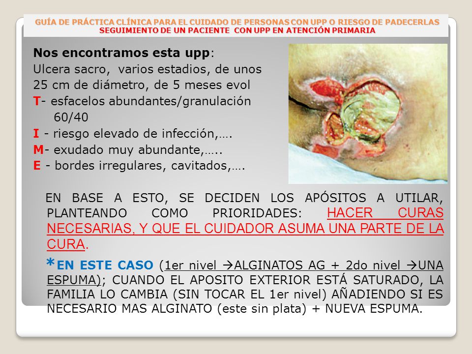 GUÍA DE PRÁCTICA CLÍNICA PARA EL CUIDADO DE PERSONAS CON UPP O RIESGO DE PADECERLAS SEGUIMIENTO DE UN PACIENTE CON UPP EN ATENCIÓN PRIMARIA