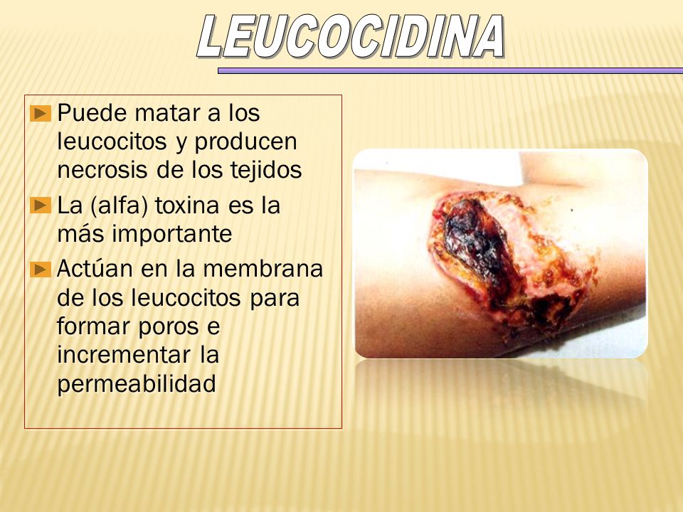 Puede matar a los leucocitos y producen necrosis de los tejidos