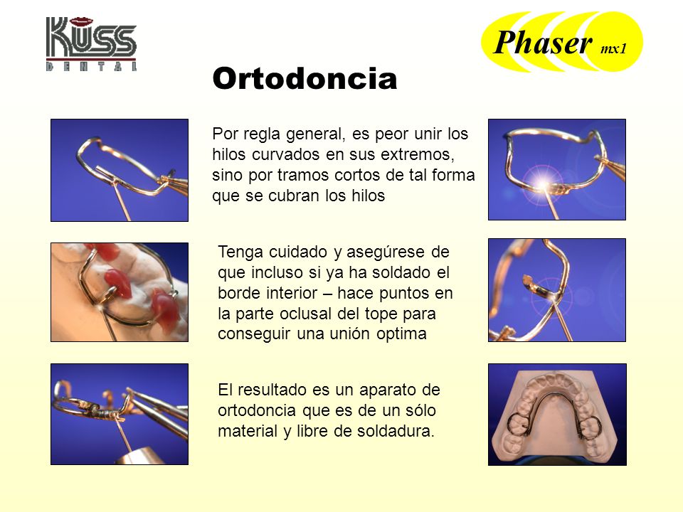 Ortodoncia Por regla general, es peor unir los hilos curvados en sus extremos, sino por tramos cortos de tal forma que se cubran los hilos.