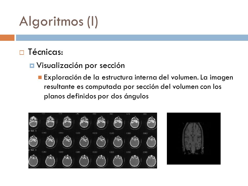 Algoritmos (I) Técnicas: Visualización por sección