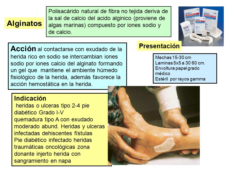 Polisacárido natural de fibra no tejida deriva de la sal de calcio del acido alginico (proviene de algas marinas) compuesto por iones sodio y de calcio.