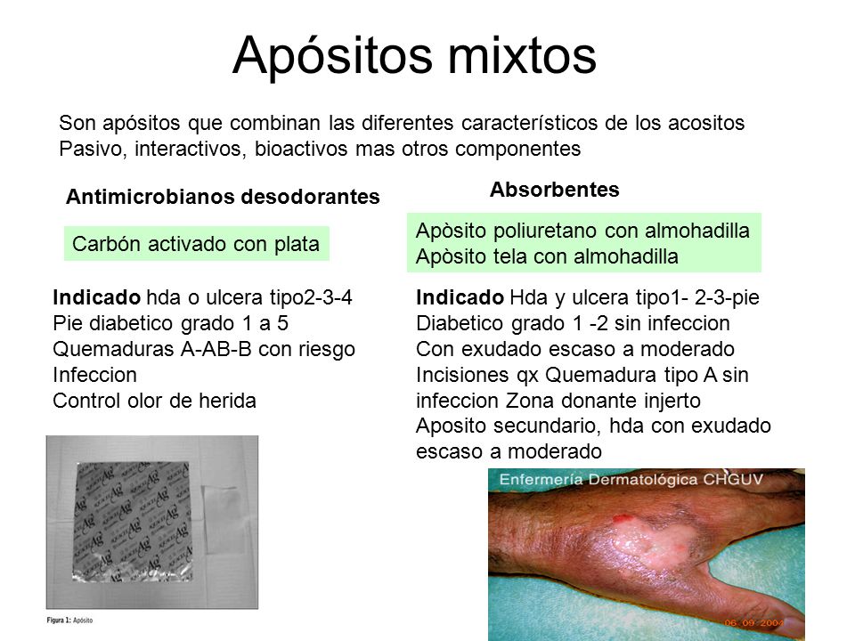 Apósitos mixtos Son apósitos que combinan las diferentes característicos de los acositos. Pasivo, interactivos, bioactivos mas otros componentes.