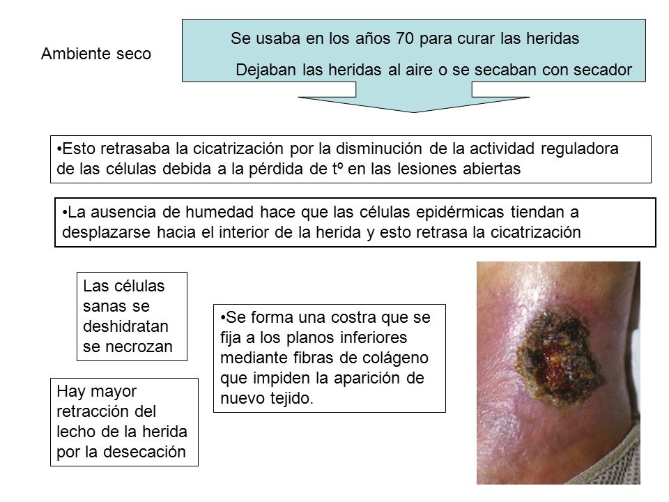 Se usaba en los años 70 para curar las heridas