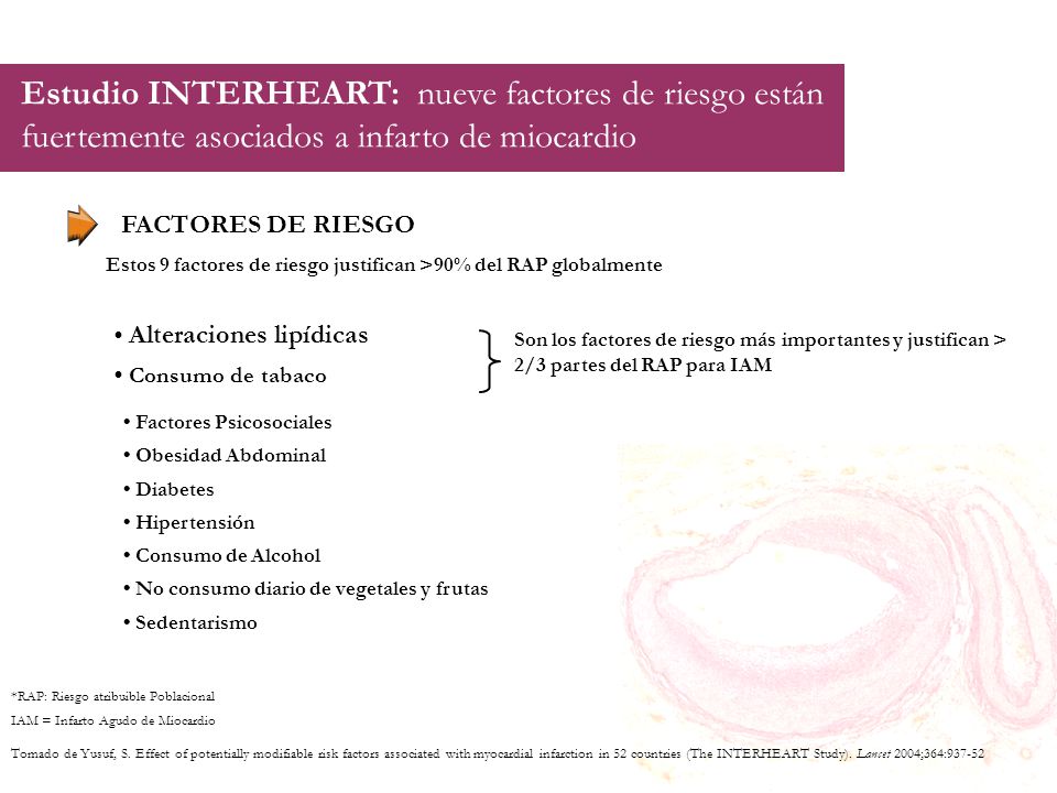 Estudio INTERHEART: nueve factores de riesgo están fuertemente asociados a infarto de miocardio