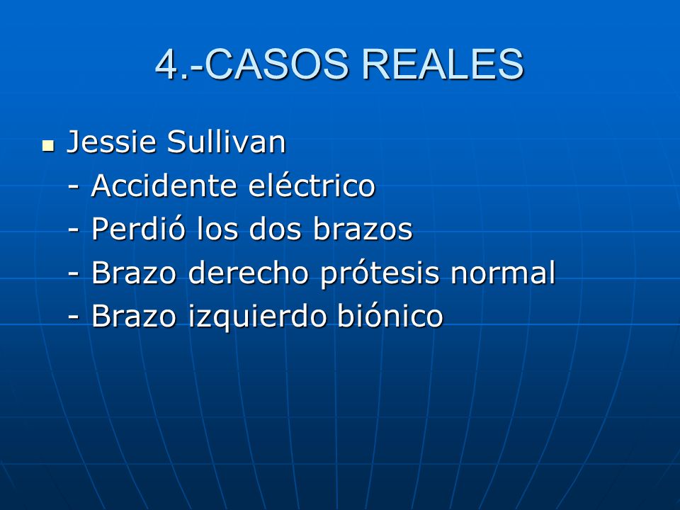 4.-CASOS REALES Jessie Sullivan - Accidente eléctrico