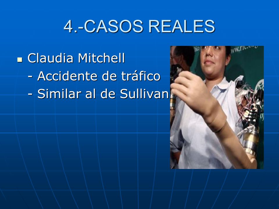 4.-CASOS REALES Claudia Mitchell - Accidente de tráfico