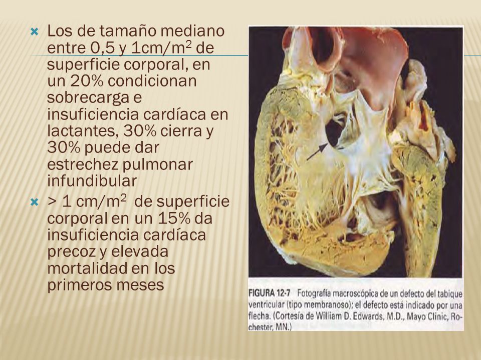 Los de tamaño mediano entre 0,5 y 1cm/m2 de superficie corporal, en un 20% condicionan sobrecarga e insuficiencia cardíaca en lactantes, 30% cierra y 30% puede dar estrechez pulmonar infundibular