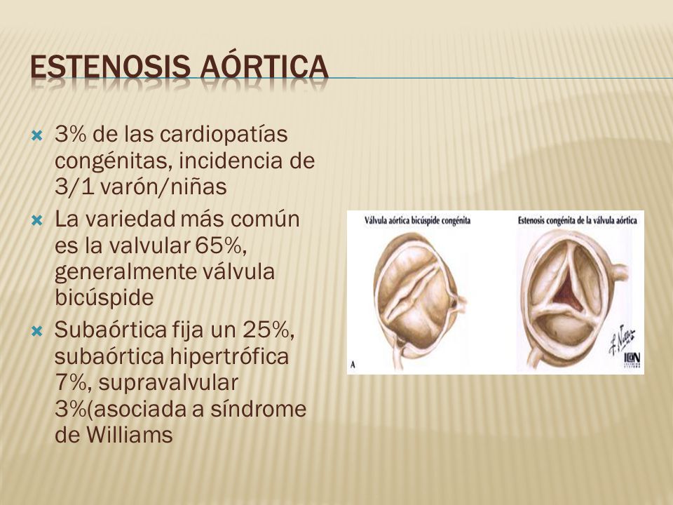 Estenosis aórtica 3% de las cardiopatías congénitas, incidencia de 3/1 varón/niñas.