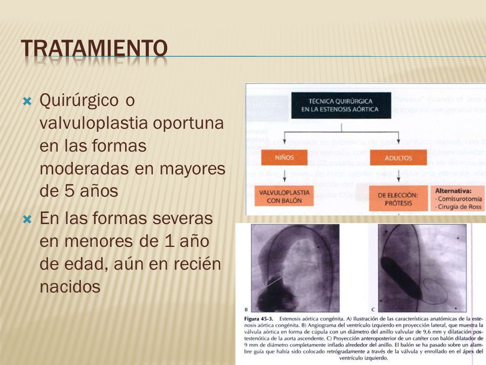 Tratamiento Quirúrgico o valvuloplastia oportuna en las formas moderadas en mayores de 5 años.