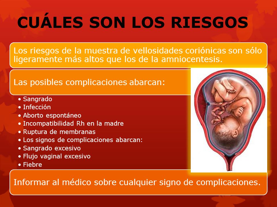 CUÁLES SON LOS RIESGOS Los riesgos de la muestra de vellosidades coriónicas son sólo ligeramente más altos que los de la amniocentesis.