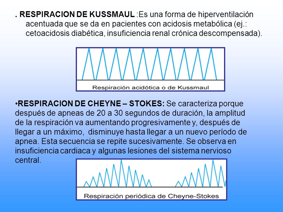 . RESPIRACION DE KUSSMAUL :Es una forma de hiperventilación acentuada que se da en pacientes con acidosis metabólica (ej.: cetoacidosis diabética, insuficiencia renal crónica descompensada).
