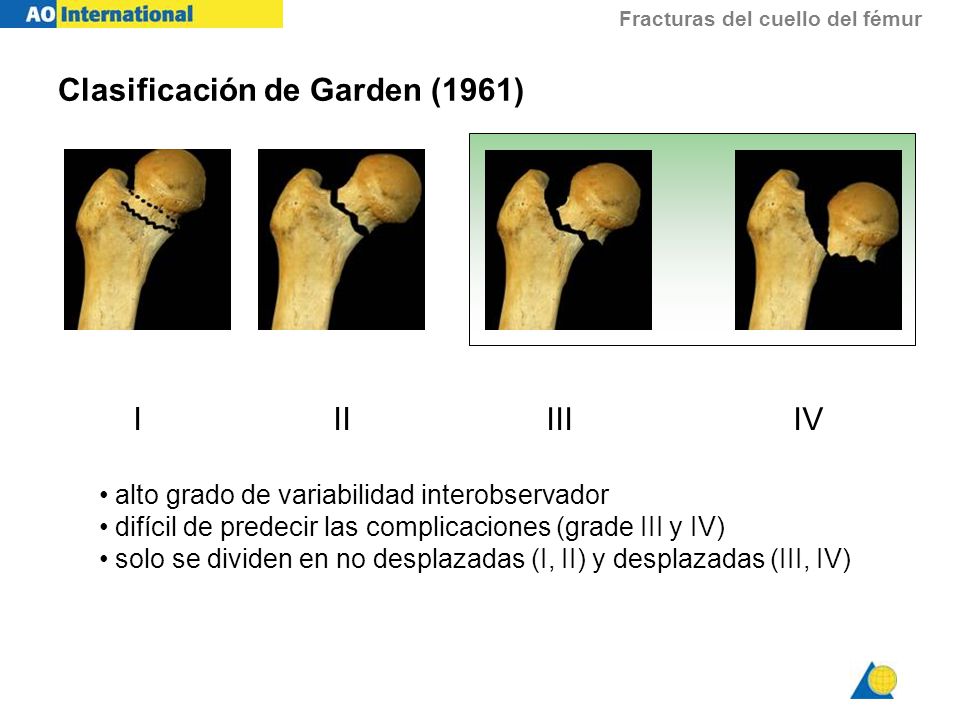 Clasificación de Garden (1961)