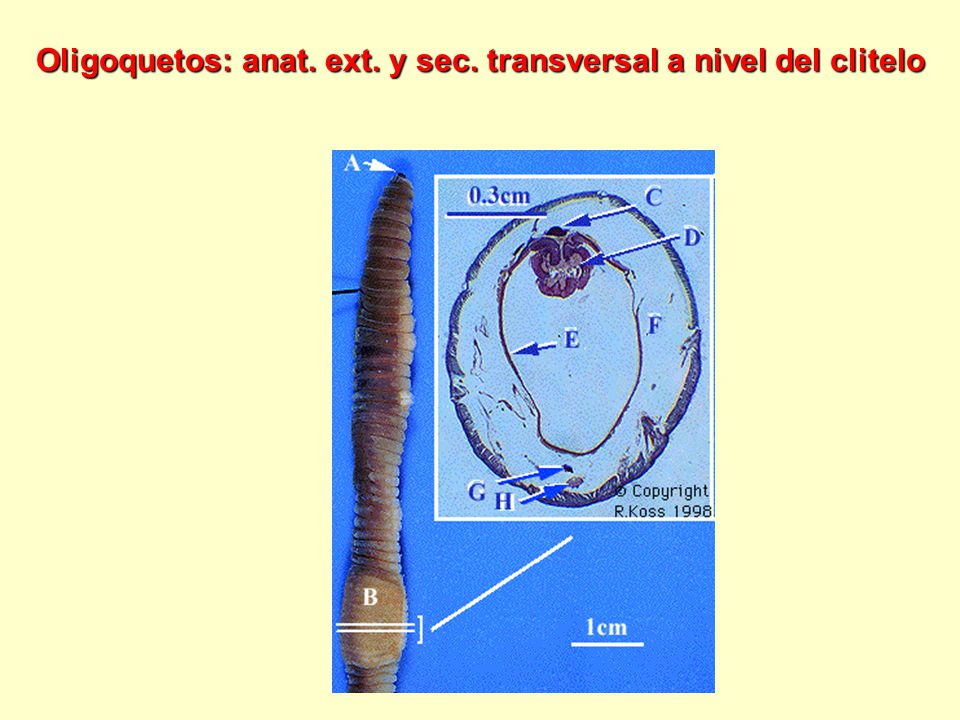 Oligoquetos: anat. ext. y sec. transversal a nivel del clitelo