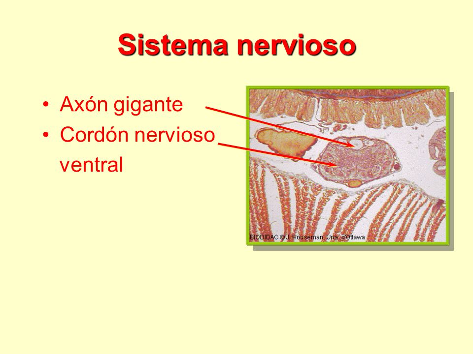 Sistema nervioso Axón gigante Cordón nervioso ventral
