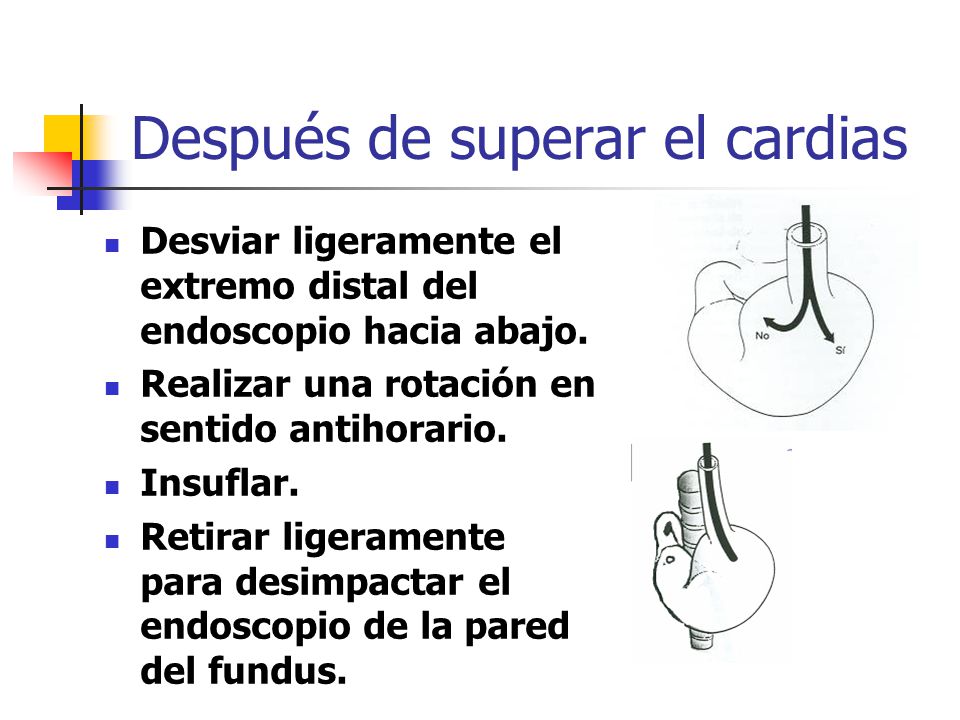 Después de superar el cardias