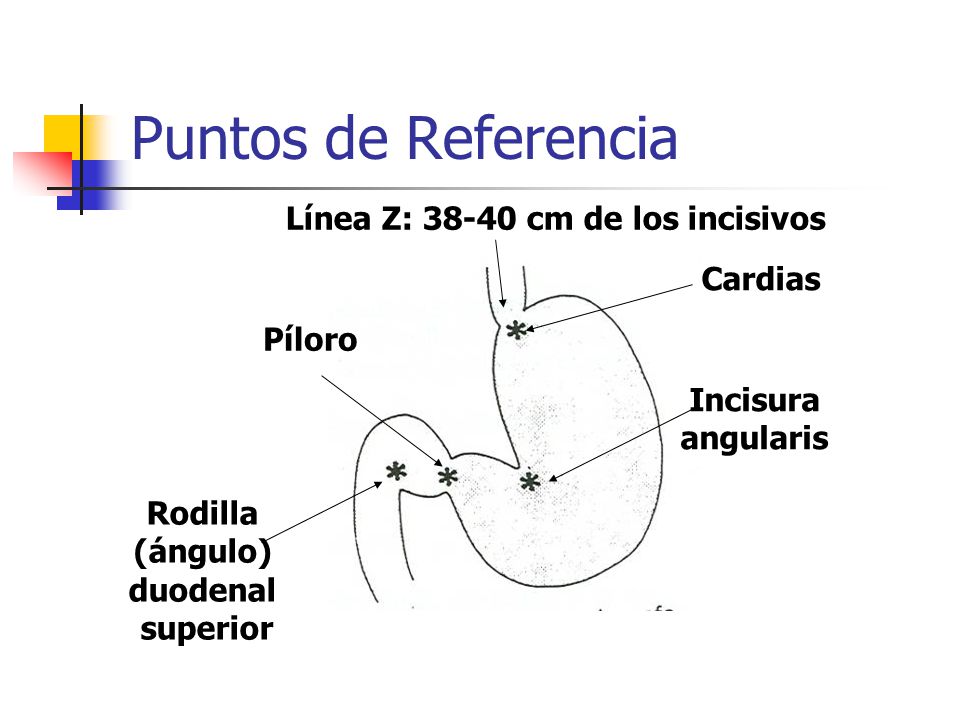 Puntos de Referencia Línea Z: cm de los incisivos Cardias Píloro