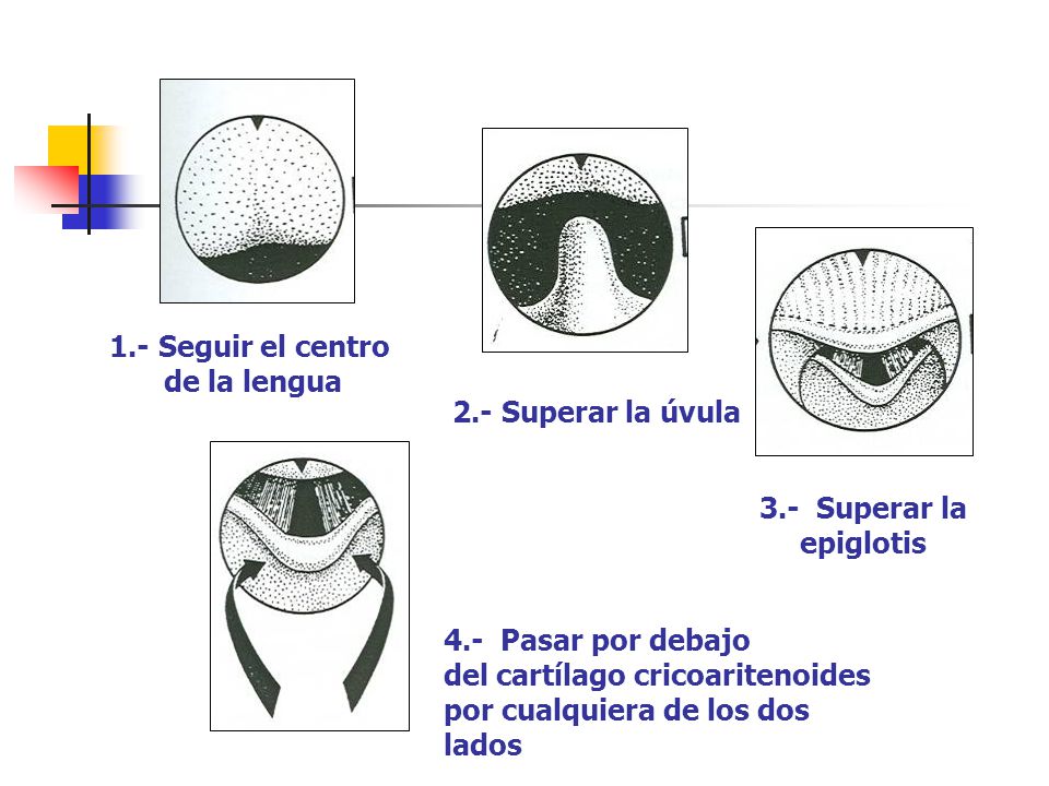 1.- Seguir el centro de la lengua. 2.- Superar la úvula. 3.- Superar la. epiglotis. 4.- Pasar por debajo.