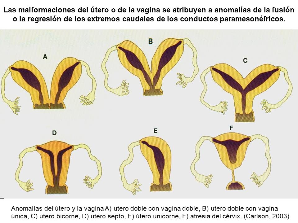 Las malformaciones del útero o de la vagina se atribuyen a anomalías de la fusión o la regresión de los extremos caudales de los conductos paramesonéfricos.