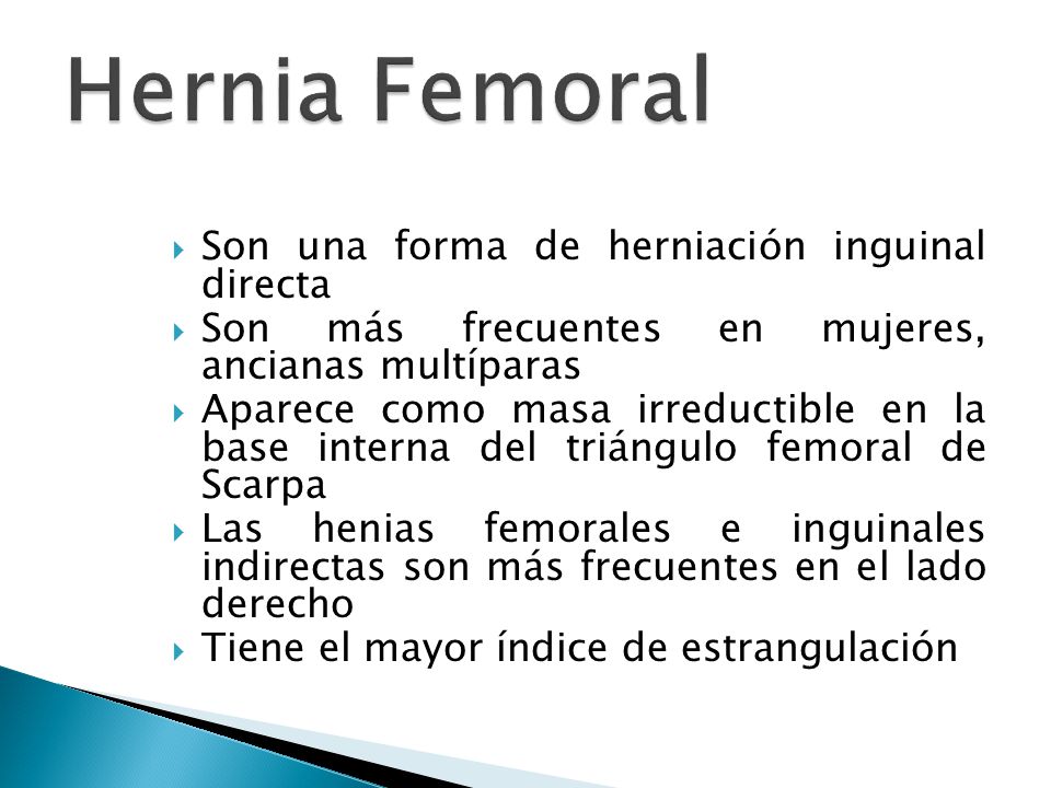 Hernia Femoral Son una forma de herniación inguinal directa