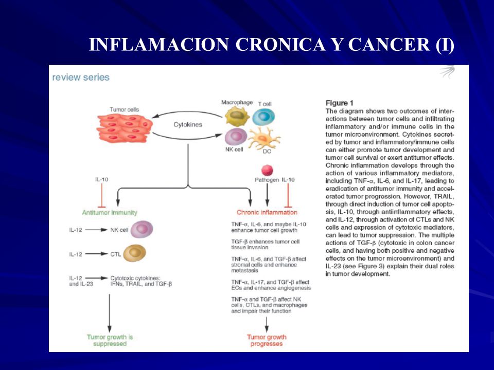 INFLAMACION CRONICA Y CANCER (I)