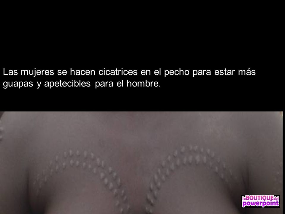Las mujeres se hacen cicatrices en el pecho para estar más guapas y apetecibles para el hombre.