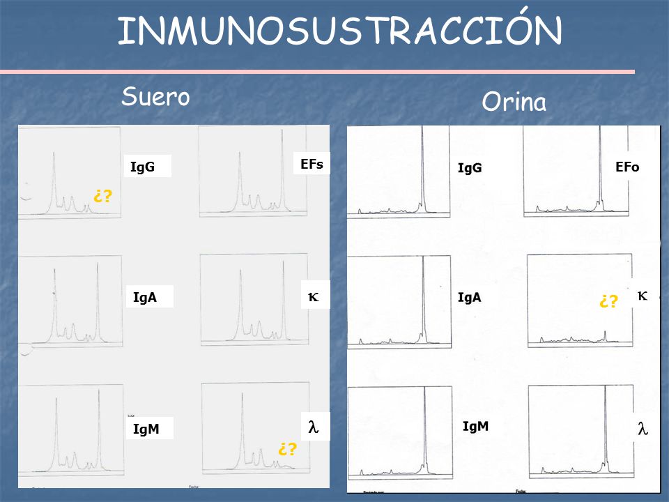INMUNOSUSTRACCIÓN Suero Orina IgG IgA IgM k l EFs EFo ¿ ¿ ¿