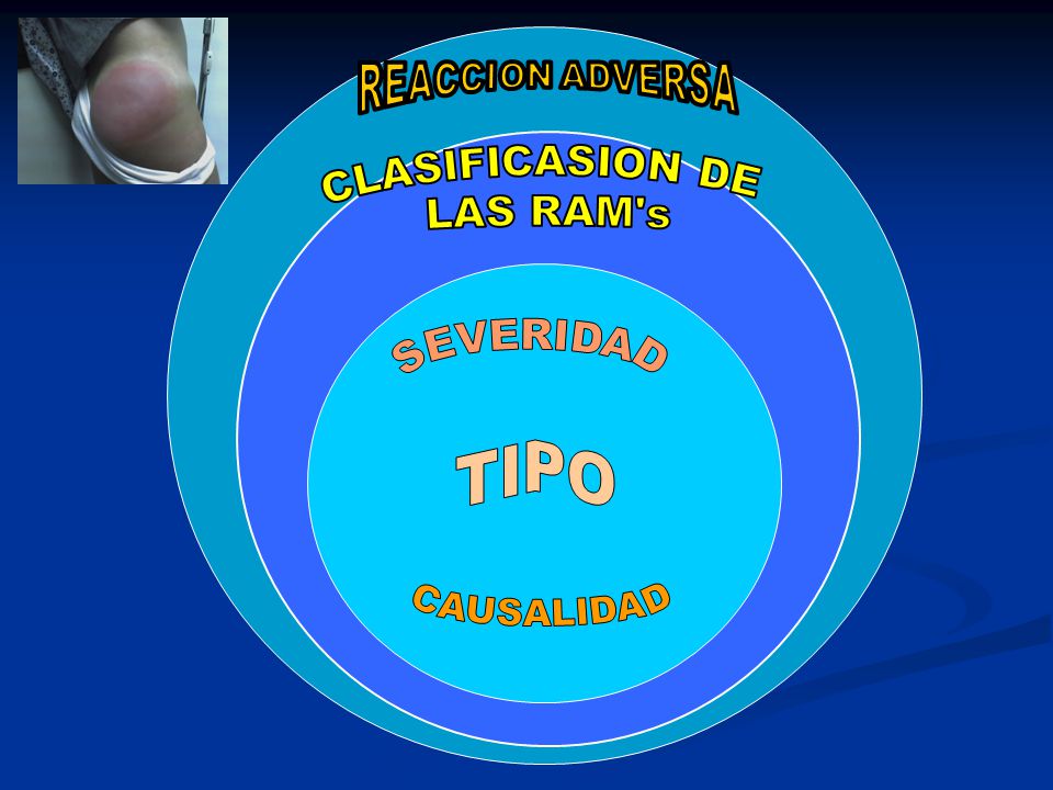 REACCION ADVERSA CLASIFICASION DE LAS RAM s SEVERIDAD TIPO CAUSALIDAD