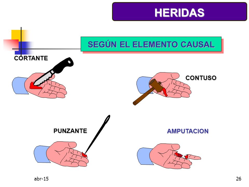 HERIDAS SEGÚN EL ELEMENTO CAUSAL CORTANTE CONTUSO PUNZANTE AMPUTACION