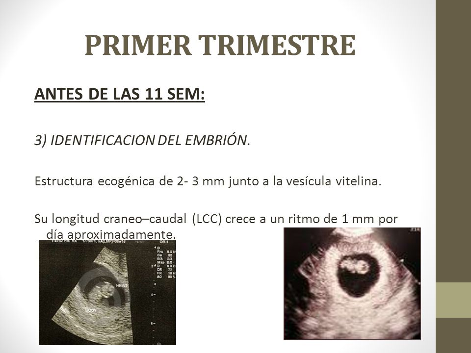 PRIMER TRIMESTRE ANTES DE LAS 11 SEM: 3) IDENTIFICACION DEL EMBRIÓN.