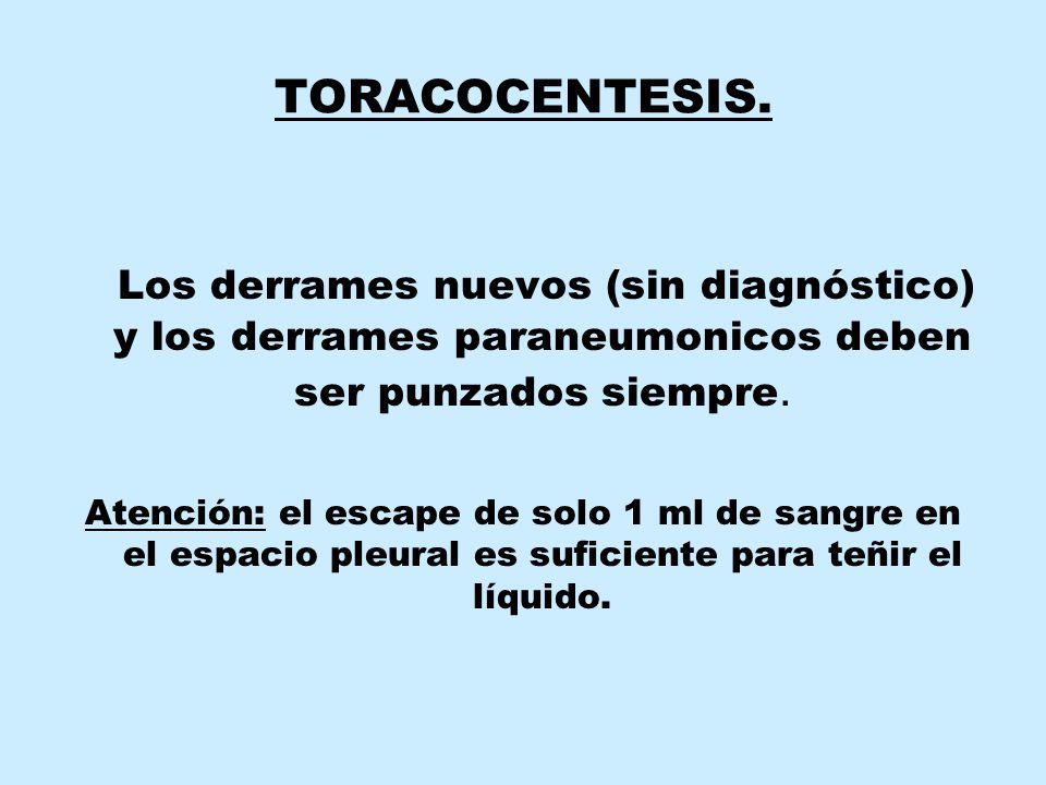 TORACOCENTESIS. Los derrames nuevos (sin diagnóstico) y los derrames paraneumonicos deben ser punzados siempre.
